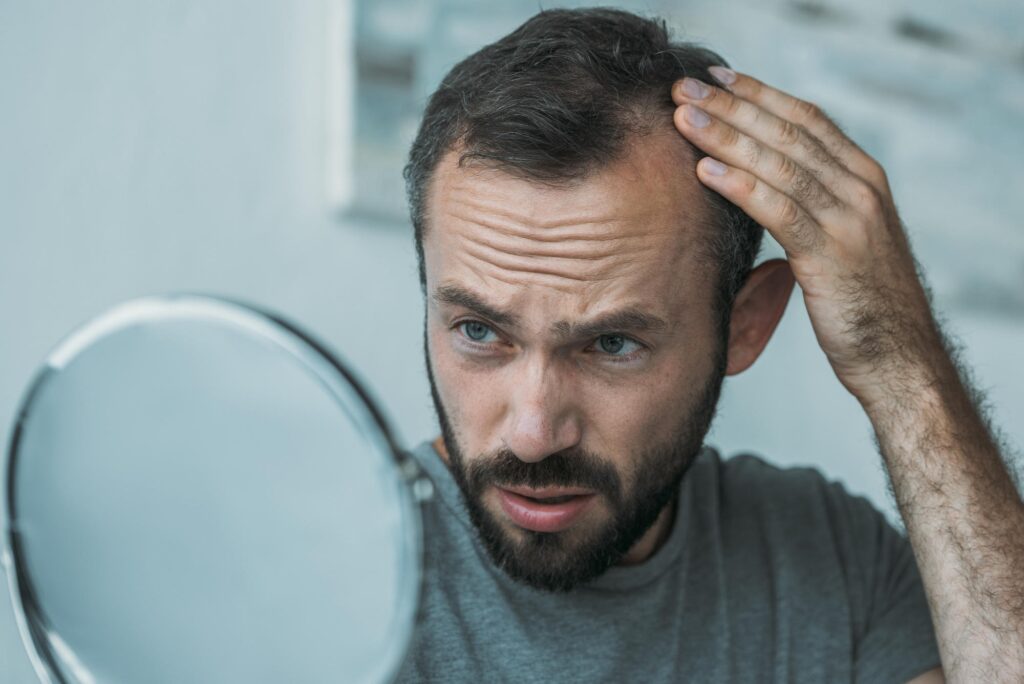 Hair Restoration Bellevue WA