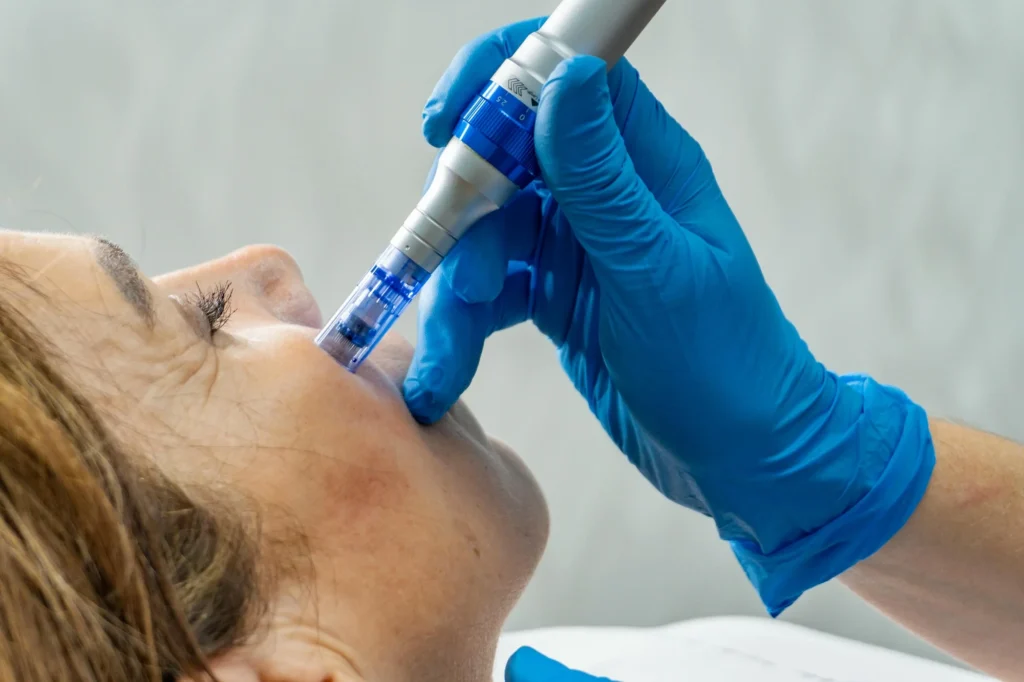 Aesthetic Treatments Bellevue WA